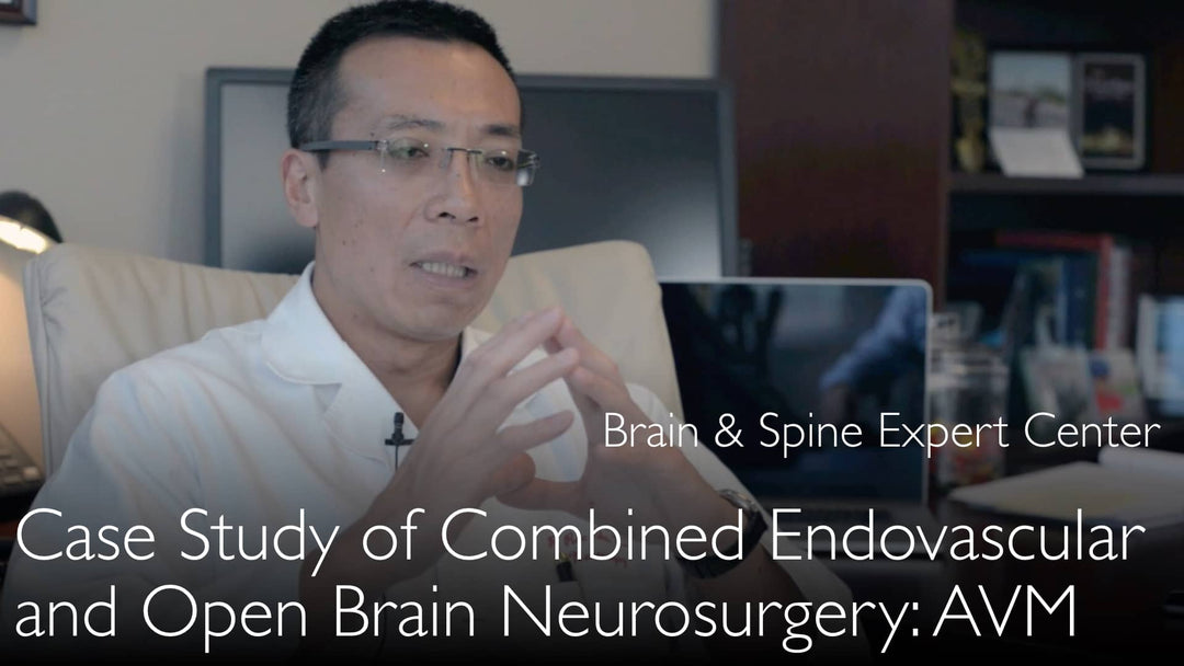 **Aneurisma Cerebral Complexo: Abordagem Endovascular e Neurocirurgia Aberta — Relato de Caso Clínico 4**
