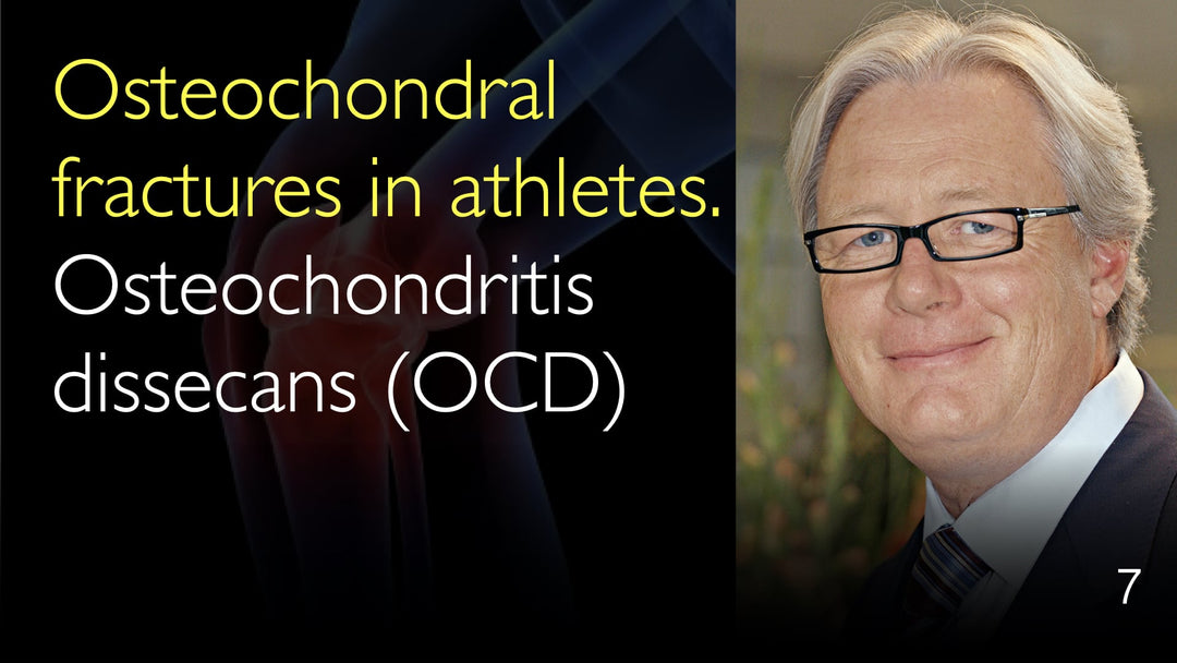 Fraturas osteocondrais em atletas 
 TOC, Osteocondrite dissecante 
 7