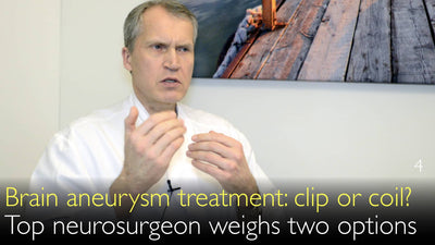 Brain aneurysm treatment. Clip, coil, or stent? How to choose best therapy for intracranial aneurysm? 4