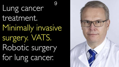 Lung cancer treatment. Minimally invasive surgery. VATS. Robotic surgery for lung cancer. 9