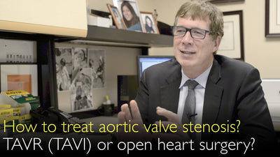 Como tratar a estenose da válvula aórtica? TAVI (Implante de Valva Aórtica Transcateter) ou cirurgia cardíaca aberta? 
 A escolha entre o  Implante de Valva Aórtica Transcateter